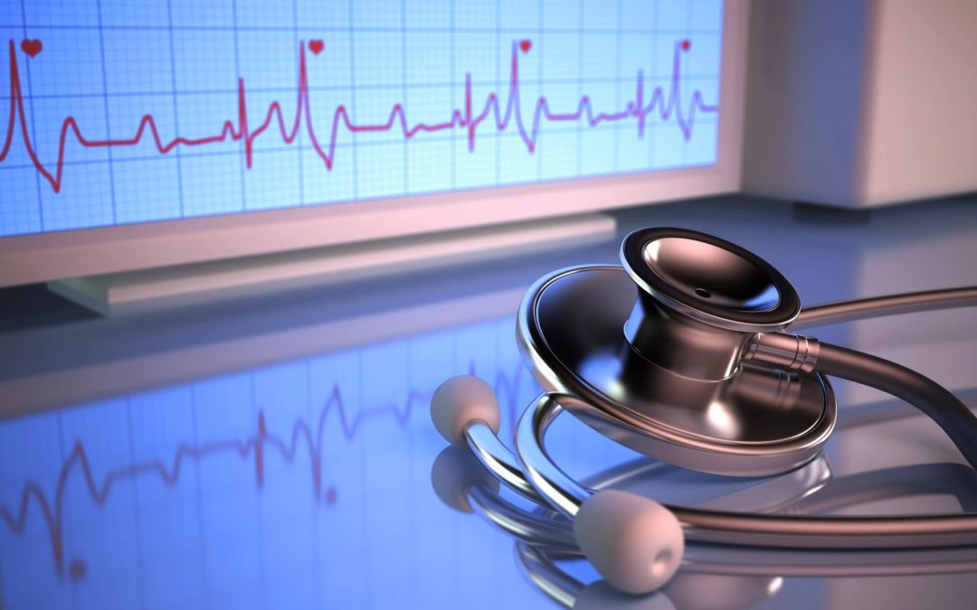 EKG for article about iron overload condition of the heart